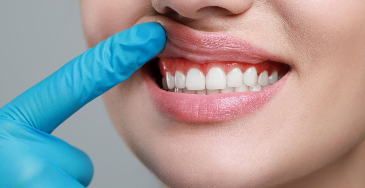 Read more about the article Gum Surgery Demystified The Benefits You Need to Know and When It’s Crucial