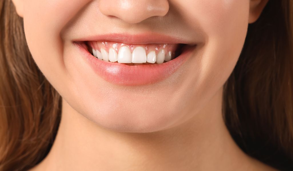 Improved Gum Health-The Benefits of Gum Surgery