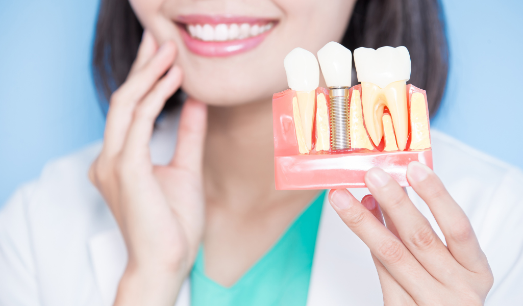 Natural Look and Feel-Dental implants mimic the appearance, function, and feel of natural teeth
