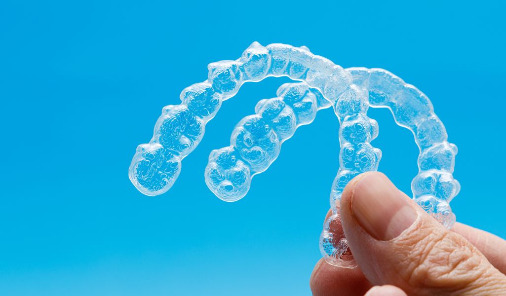 Benefits of Invisalign for Overbites and Underbites