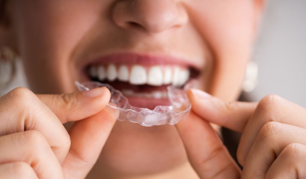 Improve the Precision of Tooth Movement