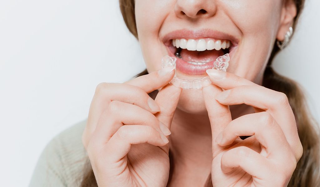 Braces and Clear Aligners Straighten Your Smile