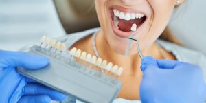 Read more about the article Exploring Teeth Whitening: Top Treatment Options, Benefits, and the Stunning Results You Can Achieve