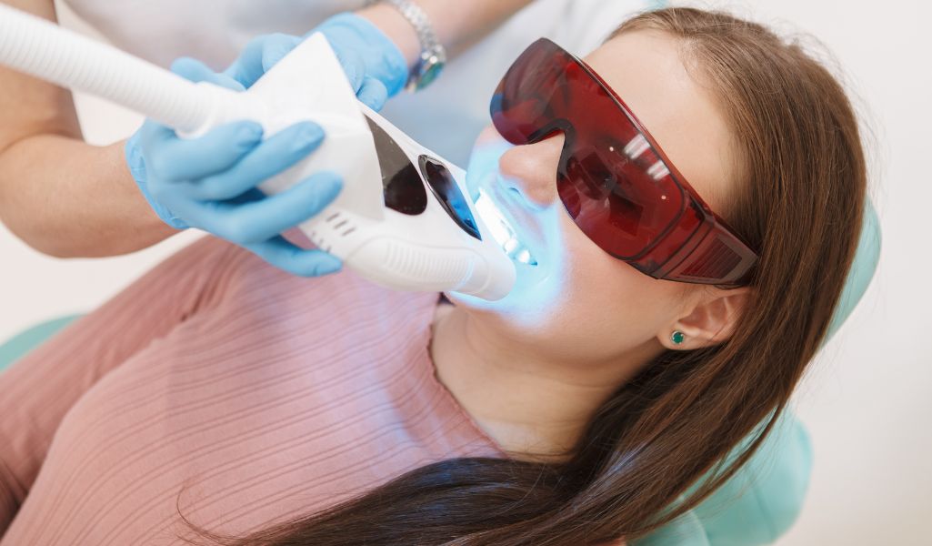 In-Office Professional Whitening