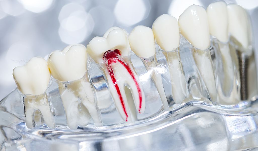 Popular Restorative Dentistry Treatments That Can Change Your Life-Root Canals