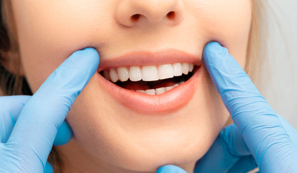 Teeth Whitening A Brighter You