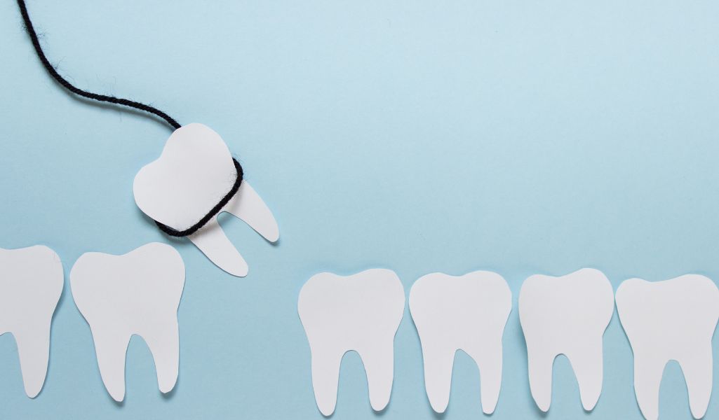 What to Expect During and After Wisdom Teeth Removal