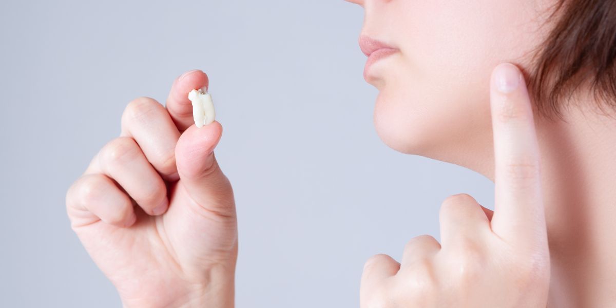 Read more about the article Why Removing Wisdom Teeth Is Vital for Your Long-Term Oral Health: The Key Benefits Explained