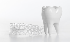 Read more about the article Best Invisible Aligners in Chennai – Expert Guide & Recommendations