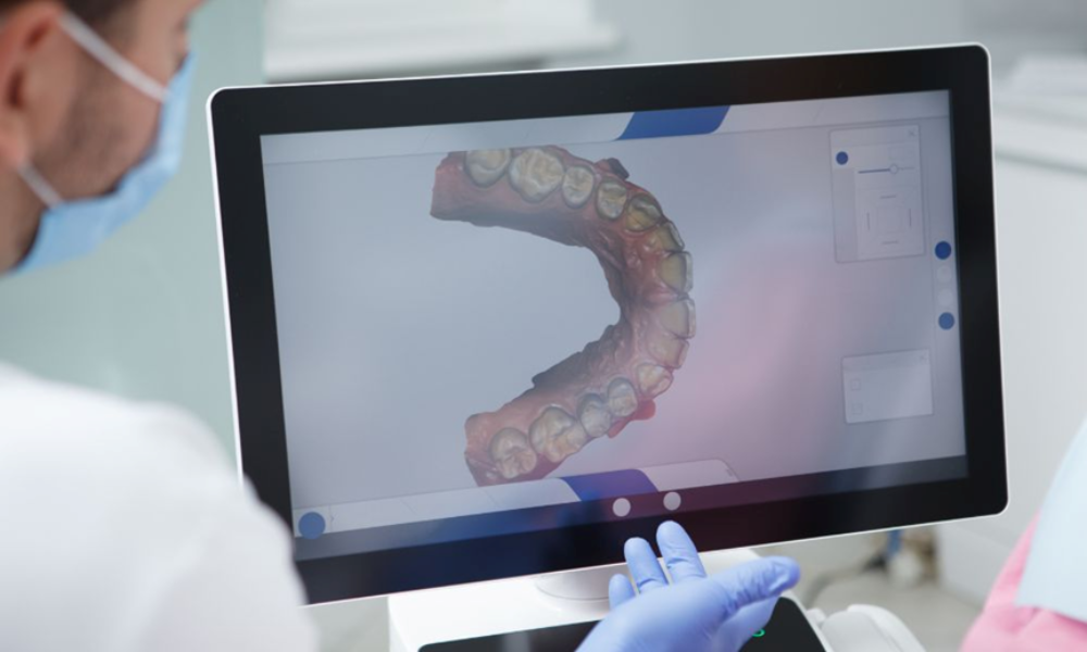 3D iTero Scanning Technology